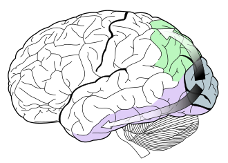 The ventral stream (in purple) is involved in object recognition. Ventral-dorsal streams.svg