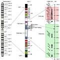 Vorschaubild für 1q21.1-Deletionssyndrom