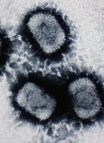 Електронна мікрофотографія трьох вірусів Cowpox