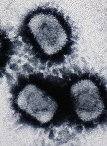 Electron micrograph of three "Cowpox virus" particles
