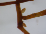 Thumbnail for File:Ectomycorrhiza in black cherry (Prunus serotina) 2.png