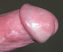[2] die Eichel von rechts im erigierten Zustand des Penis mit zurückgezogener Vorhaut