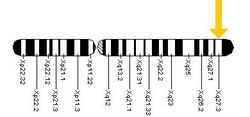 FMR1 geninin yerləşməsi