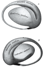 Vignette pour Noyau lenticulaire