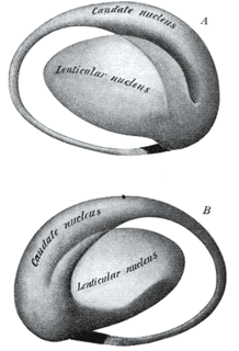 Lentiform nucleus