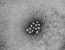 Hepatitis A virus 01.jpg