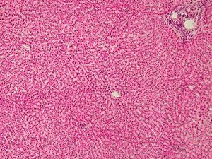 Histologische bereiding van menselijk leverweefsel, hematoxyline-eosinekleuring.