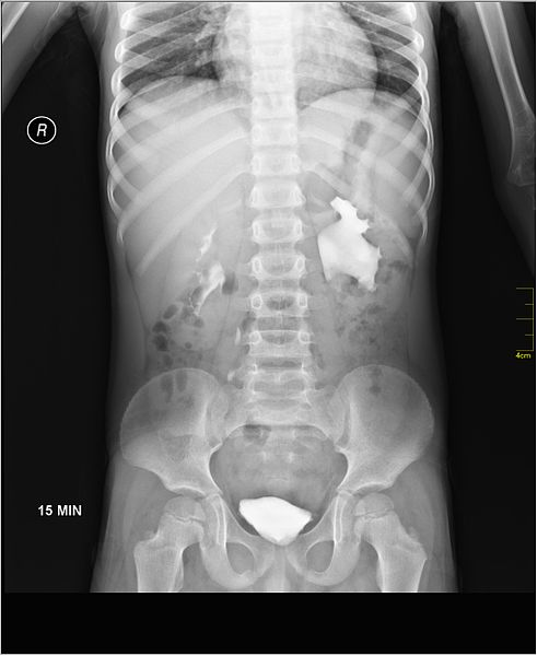 File:Medical X-Ray imaging RGN06 nevit.jpg