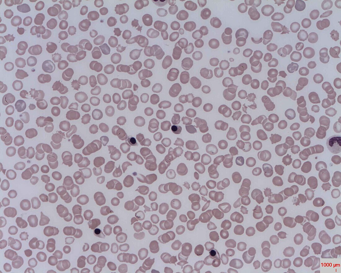 Nucleated red blood cell