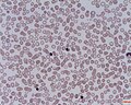 Thumbnail for Nucleated red blood cell