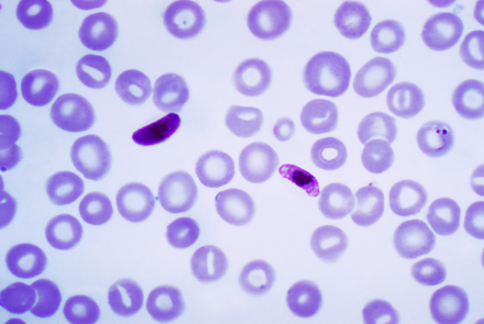 Клетка паразита. Малярийный плазмодий falciparum. Малярийный плазмодий Plasmodium falciparum;. Plasmodium falciparum гаметоцит. Малярийный плазмодий фальципарум.