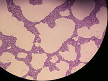 .Rhodotorula mucilaginosa cells, Methylene blue stain, magnification 400x Rhodotorula mucilaginosa 400x img430.jpg
