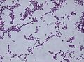 Bacillus subtilis Gram stain.jpg