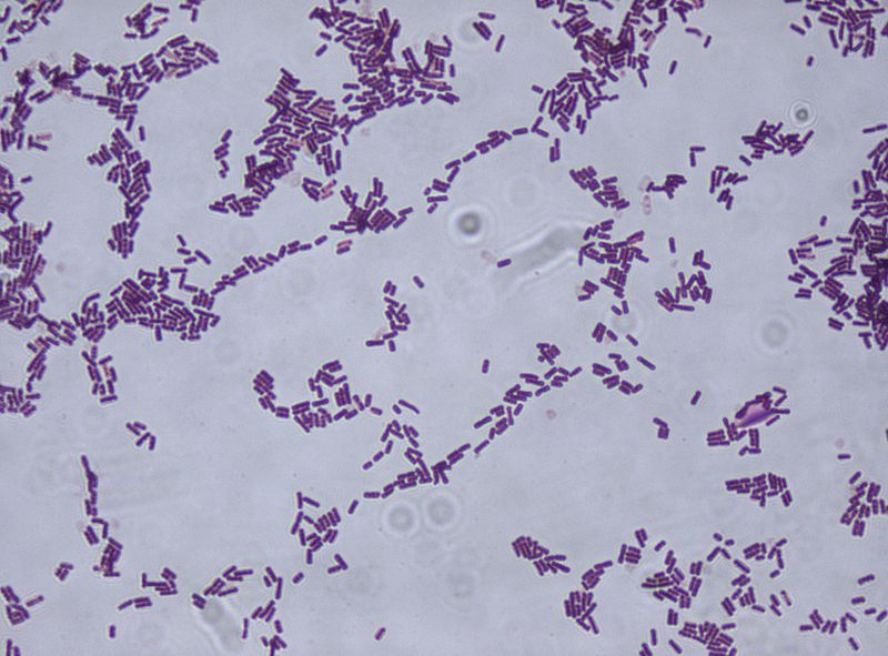 File:Bacillus subtilis Gram stain.jpg