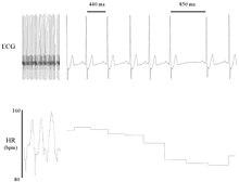 In 2011, Billman published a review article on heart rate variability, illustrated here by an electrocardiogram recording of canine heart beat. Heart rate variability ECG.jpg