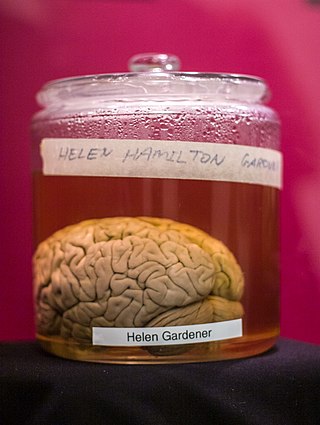 <span class="mw-page-title-main">Wilder Brain Collection</span> Brain collection at Cornell University