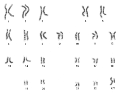 Human male karyotype Human male karyotype.gif