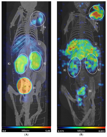 SPECT-CT images at (a) 4h post injection and (b) 24h post injection MEDICIS imaging.png