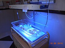 Phototherapy is the main treatment of neonatal jaundice Phototherapy1.jpg