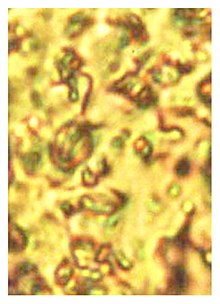 Trypanosoma antiquus in fecal droplet of Triatoma dominicana.jpg
