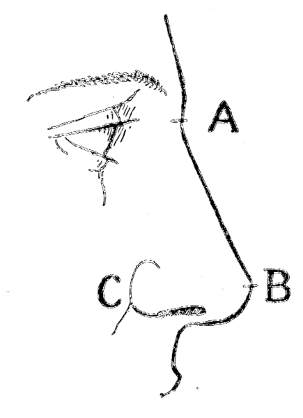 File:Bertillon - Identification anthropométrique (1893) 155 n&b.png