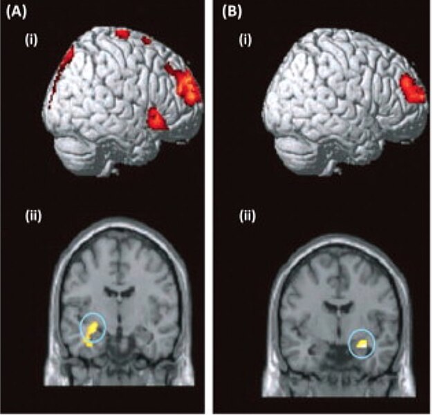 File:Brain-imaging data.jpg