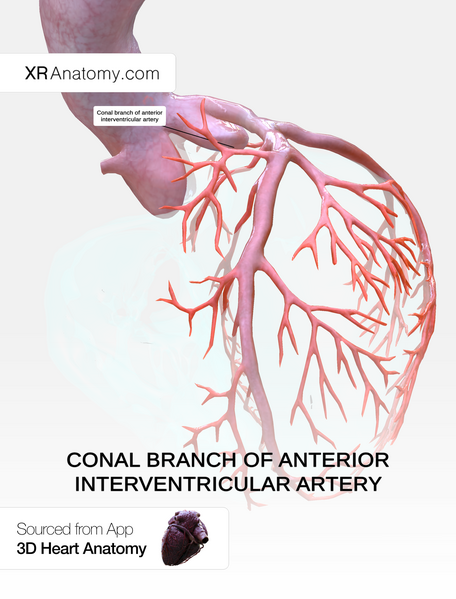 File:Conal branch of anterior interventricular artery.png