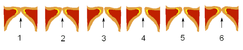 File:Glottal Cycle Falsett.gif