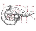 Thumbnail for Uncinate process of pancreas