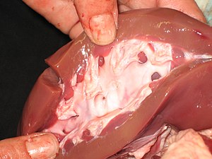 Riñón: Anatomía, Histología, Fisiología renal