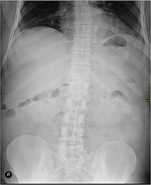 File:Medical X-Ray imaging PSU06 nevit.jpg