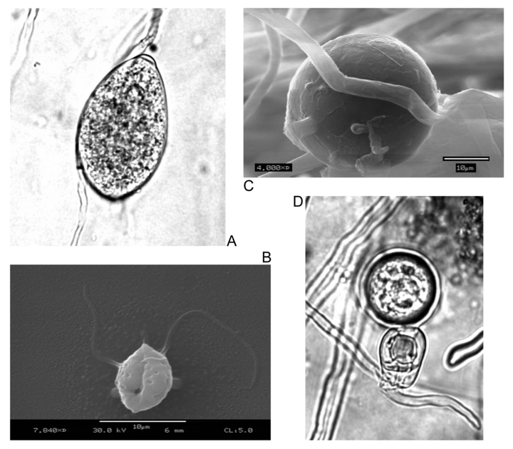 Phytophthora forms: A: Sporangia. B: Zoospore. C: Chlamydospore. D: Oospore