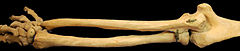 Bones of the right arm, showing the ulna, radius, wrist and humerus