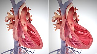 Pathophysiology of heart failure