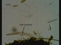 Dosya: Spirostomum teres.ogv