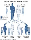 X linked dominant/mother