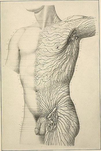 American practice of surgery; a complete system of the science and art of surgery (1906) (14584335740).jpg