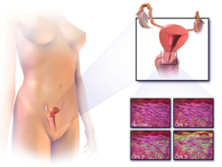 موقع سرطان عنق الرحم ومثال على خلايا طبيعية وأخرى غير طبيعية (سرطانية).