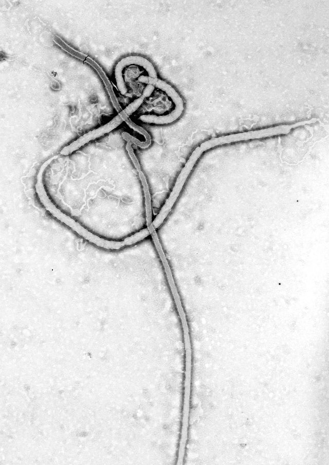 Electron micrograph of Ebola virus