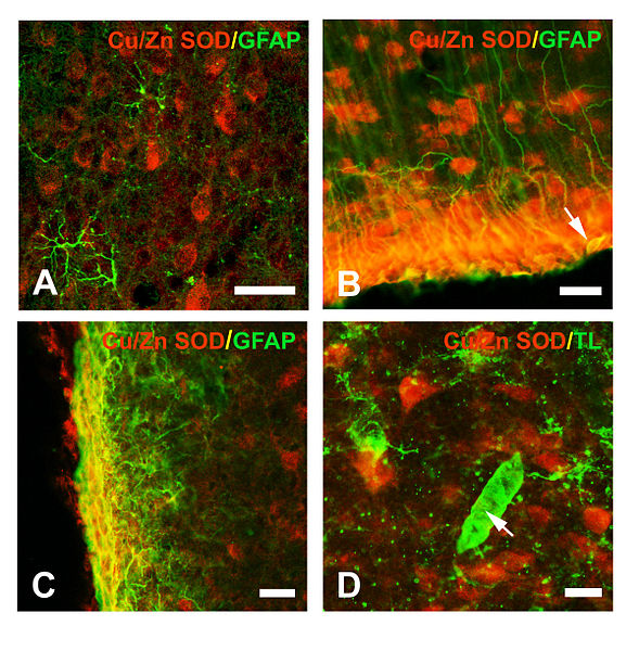 File:Glial distribution of Cu Zn SOD immunoreactivity in intact immature rat brain.jpg