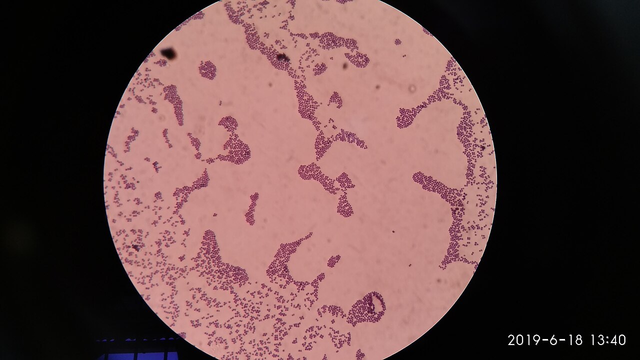 File:Staphylococcus aureus Gram stain.jpg - Wikimedia Commons