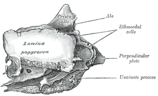 <span class="mw-page-title-main">Orbital lamina of ethmoid bone</span>