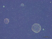 Колонии Phaeocystis globosa.