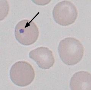 Howell–Jolly body Cluster of DNA in red blood cells