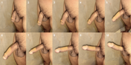 Lateral view of an un-circumcised human penis during various stages of erection.png