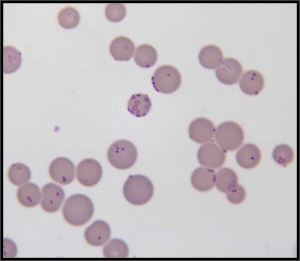 Mycoplasma