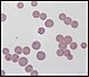 Mycoplasma