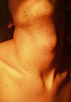 Male neck.jpg