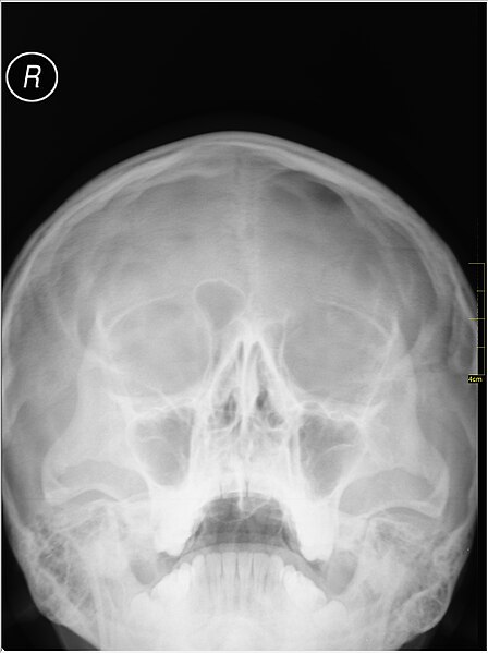 File:Medical X-Ray imaging WGQ07 nevit.jpg