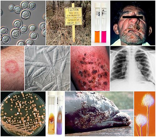 Tiled images of medical fungi